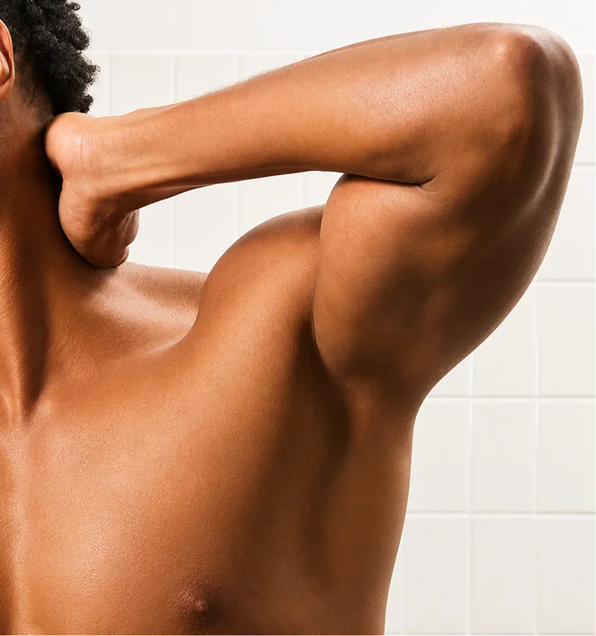 Laser hair removal for underarms treatment at Elevate Aesthetics